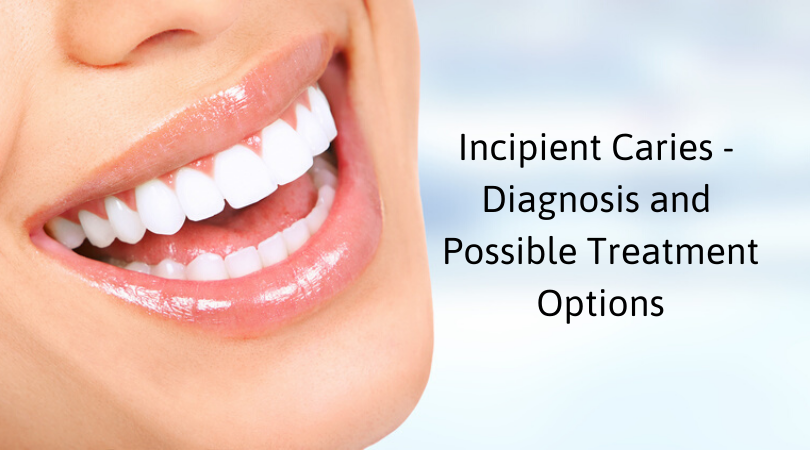 Incipient Caries - Diagnosis and Possible Treatment Options